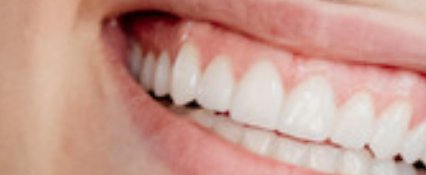 Sonrisa